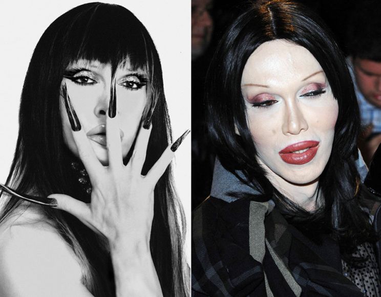 Pete Burns