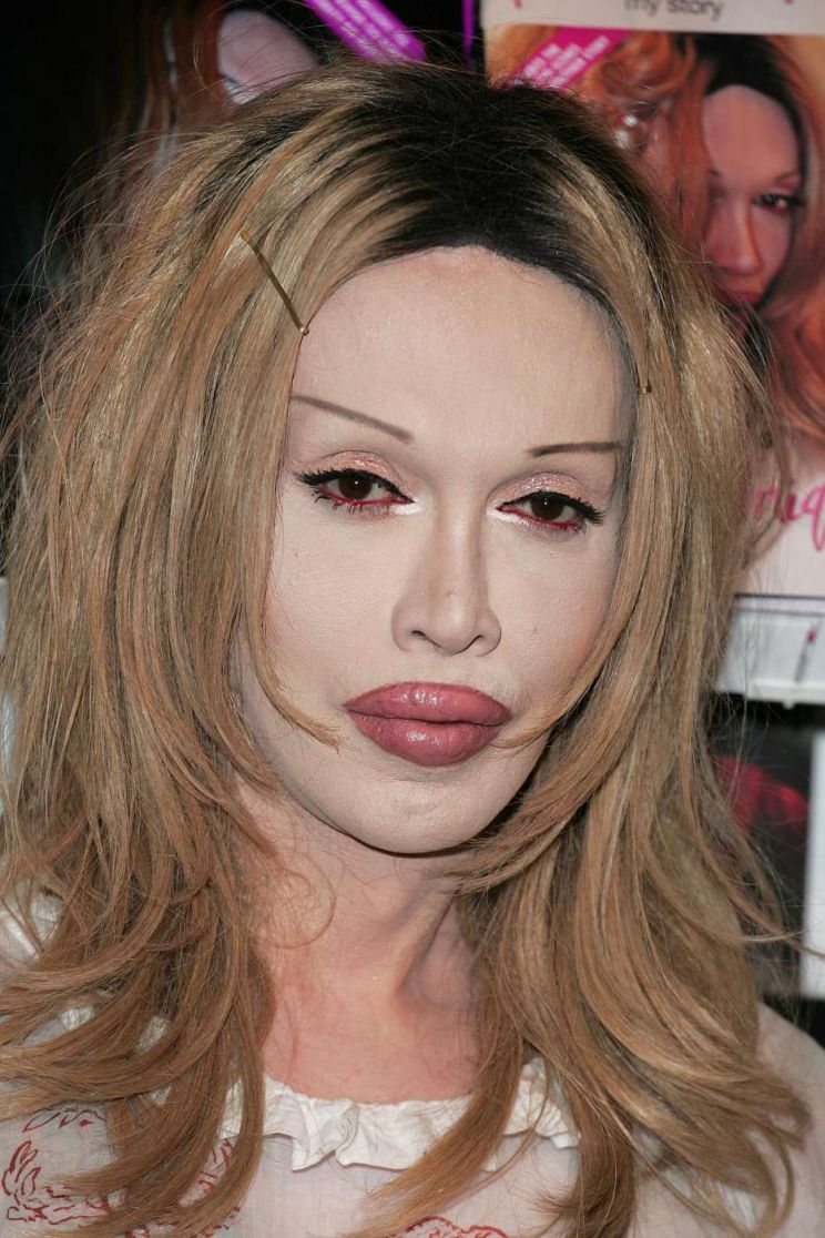 Pete Burns