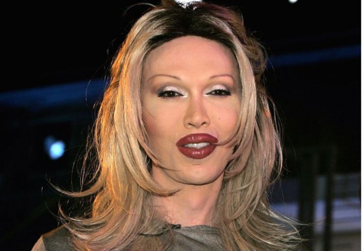 Pete Burns