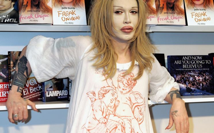 Pete Burns
