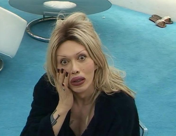 Pete Burns