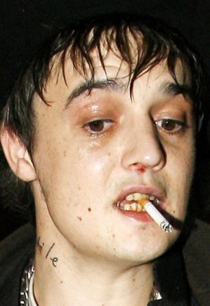 Pete Doherty