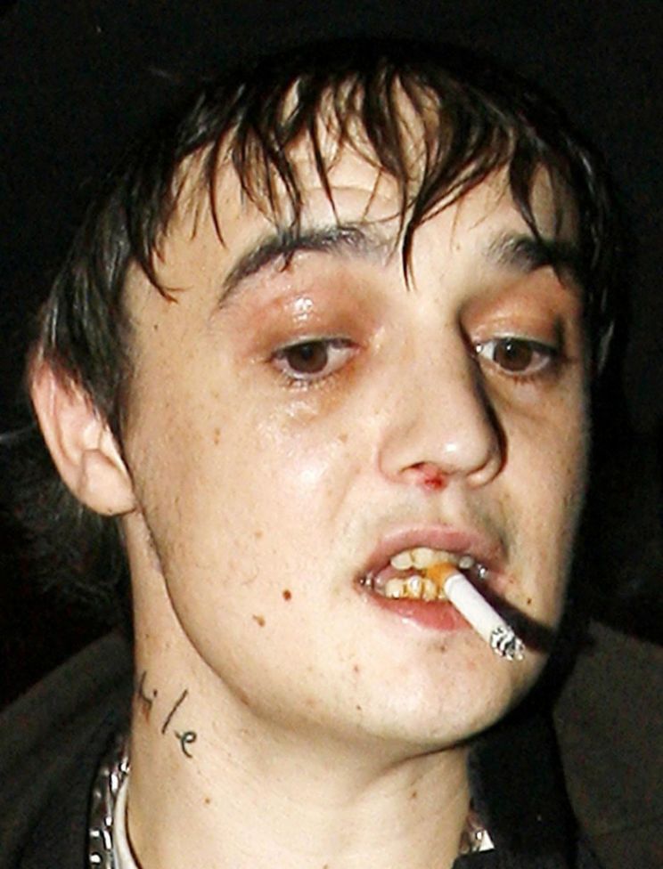 Pete Doherty