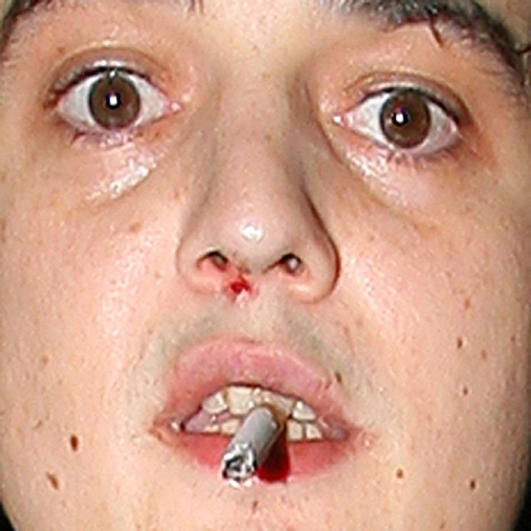 Pete Doherty