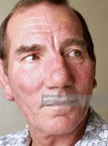 Pete Postlethwaite