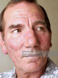 Pete Postlethwaite