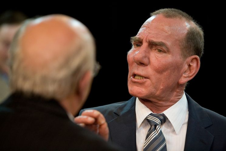 Pete Postlethwaite