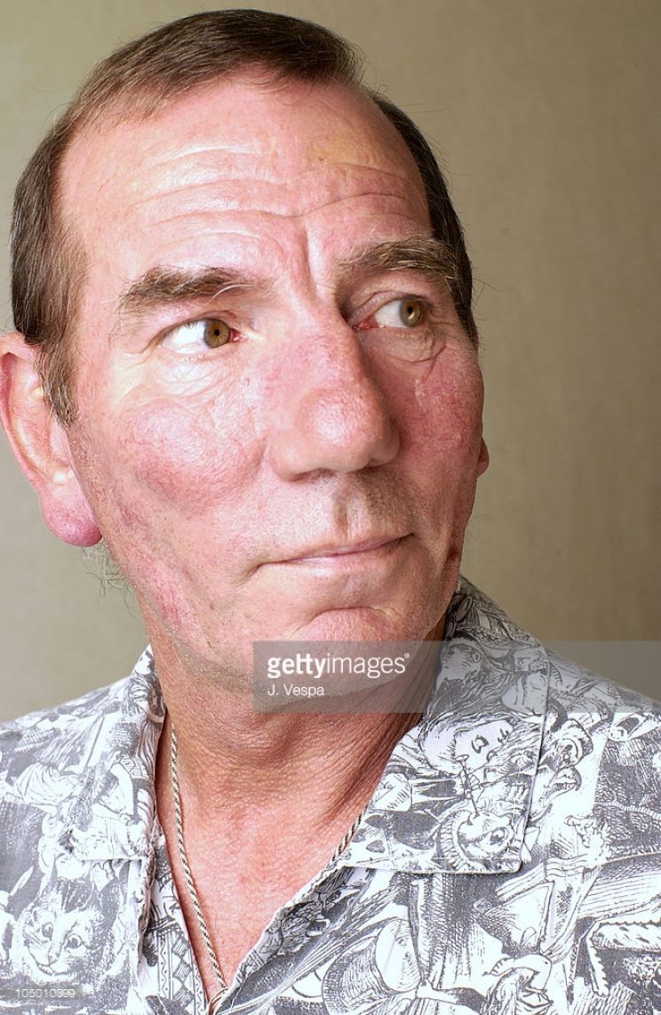 Pete Postlethwaite