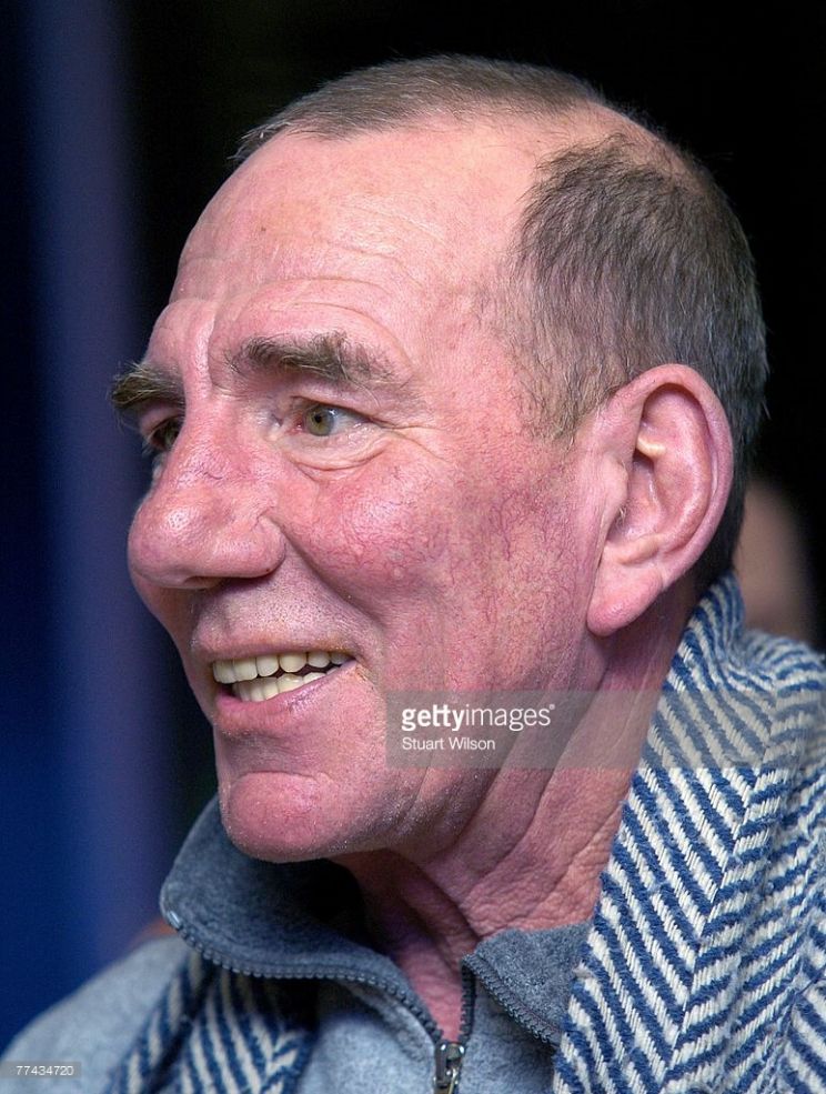 Pete Postlethwaite