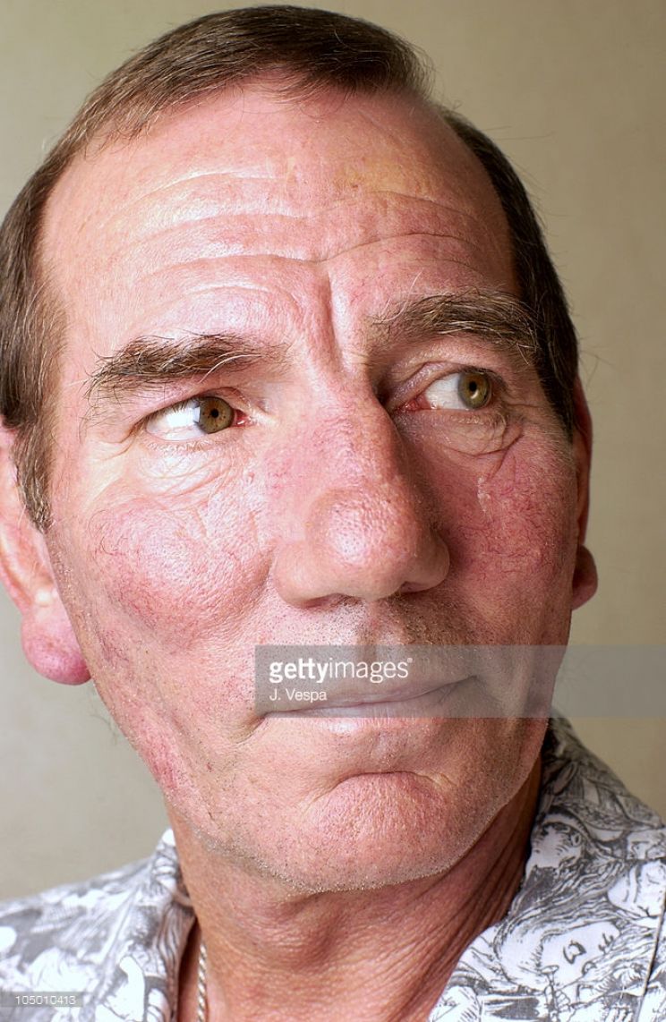 Pete Postlethwaite