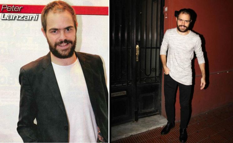 Peter Lanzani