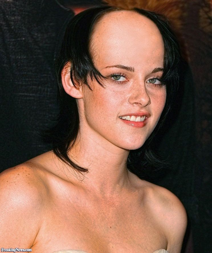 Rebecca Balding