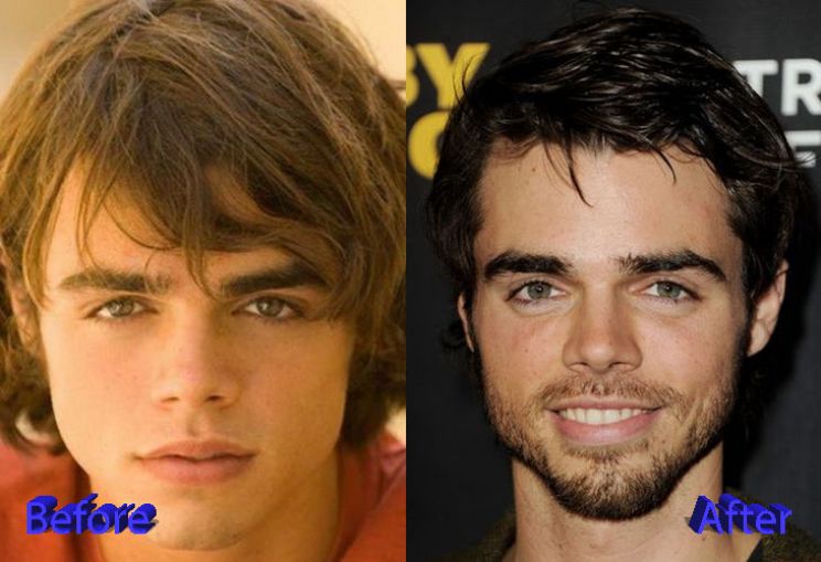 Reid Ewing