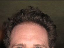 Remy Auberjonois