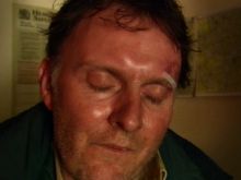 Robert Glenister