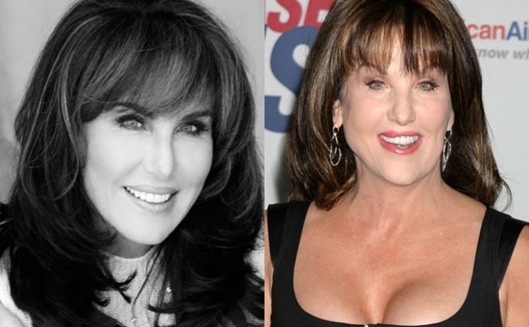 Robin McGraw