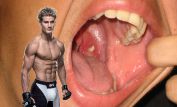 Sage Northcutt