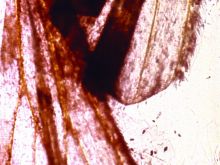 Stan Brakhage