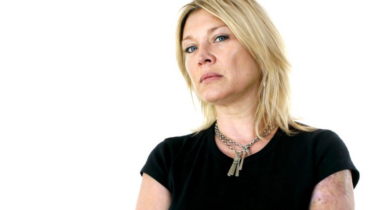 Sue Jones-Davies