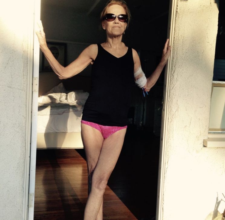 Suzanne Rico