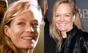 Suzy Amis