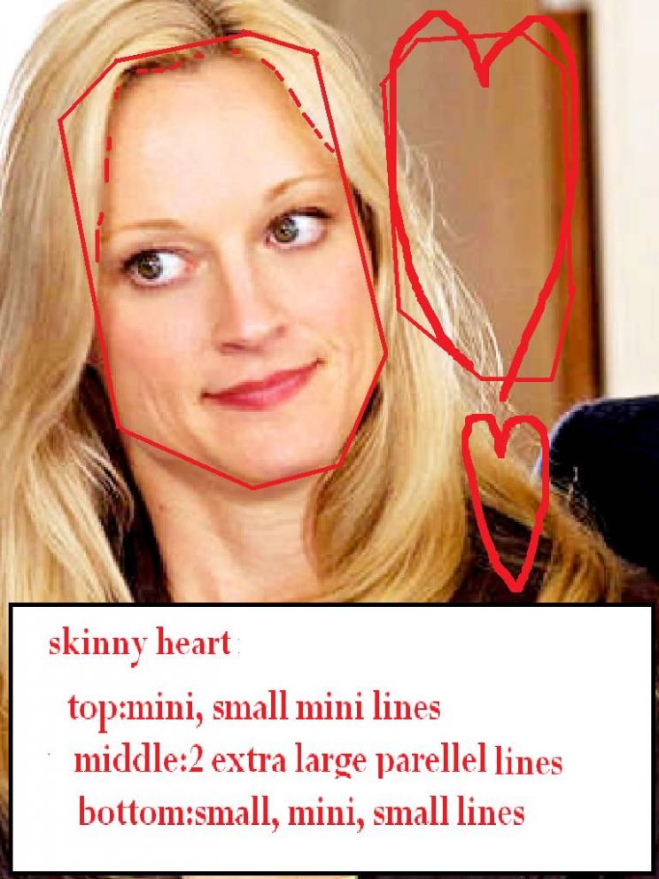 Teri Polo