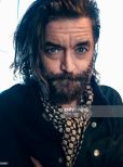 Timothy Omundson