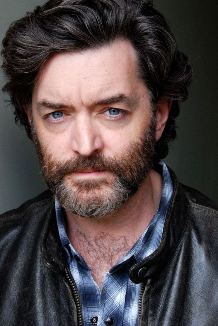 Timothy Omundson