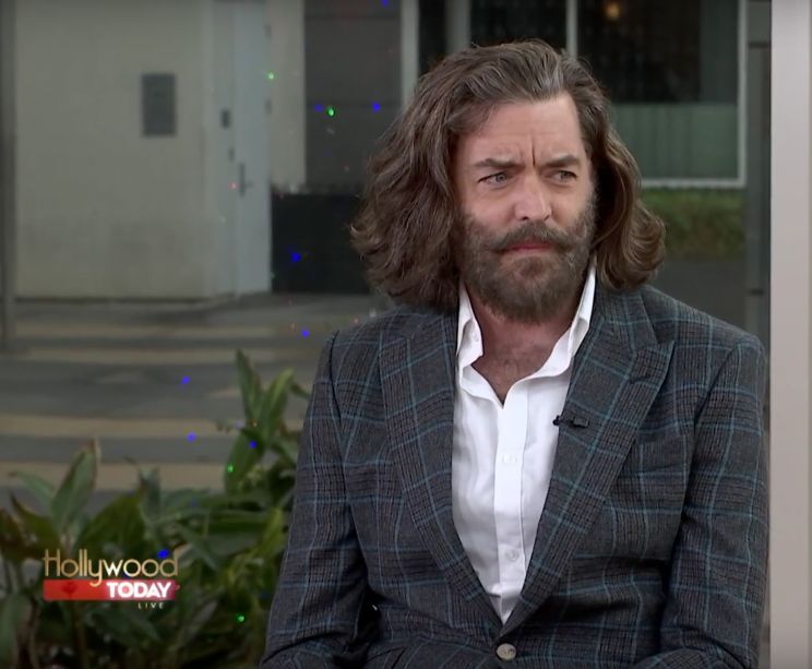 Timothy Omundson