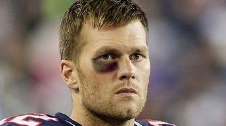 Tom Brady