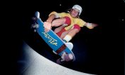 Tony Alva