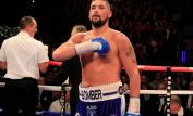 Tony Bellew