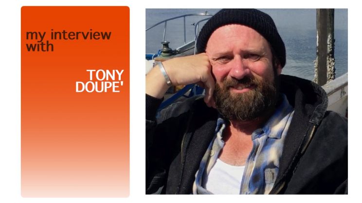Tony Doupe