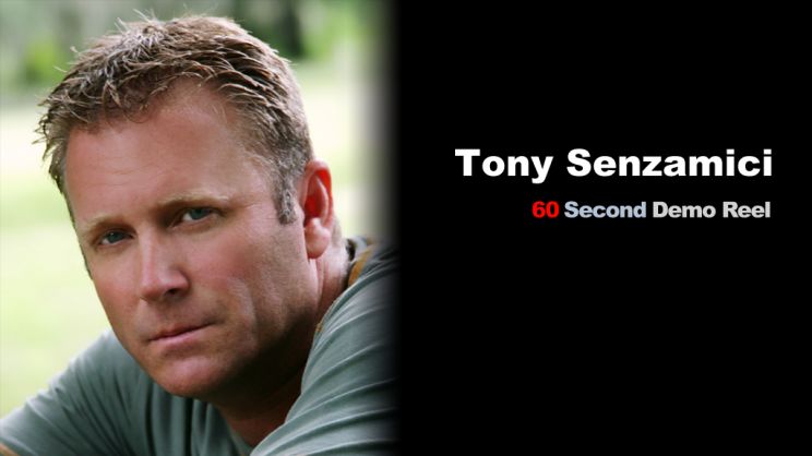 Tony Senzamici