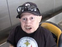 Verne Troyer