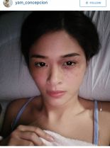 Yam Concepcion