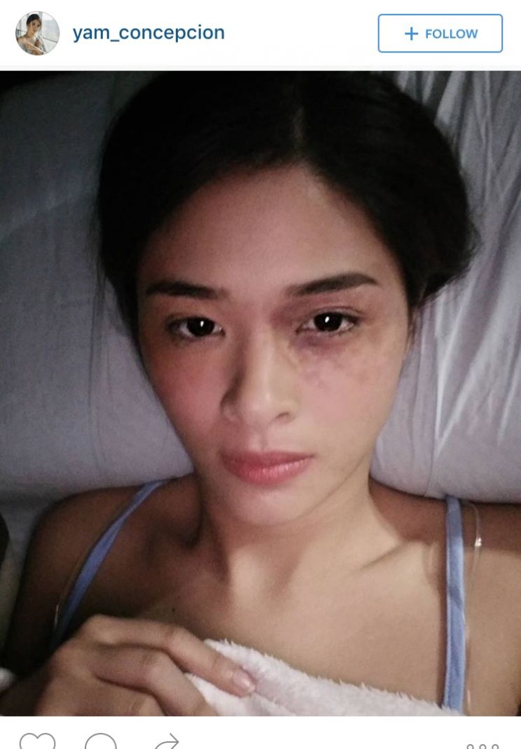 Yam Concepcion